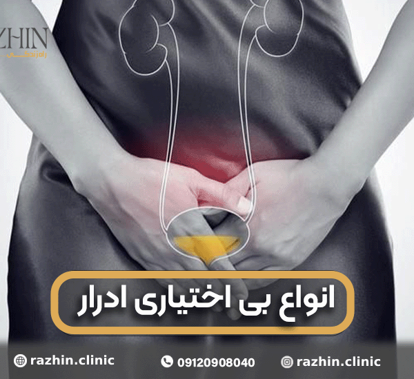بررسی انواع بی اختیاری ادرار