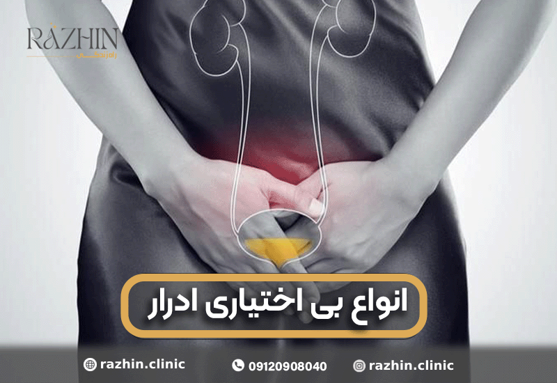 بررسی انواع بی اختیاری ادرار