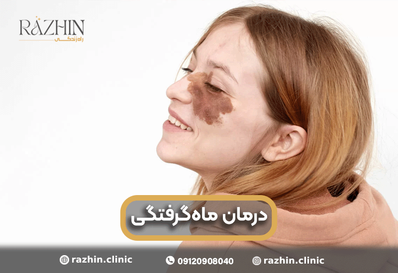 لکه ماه گرفتگی