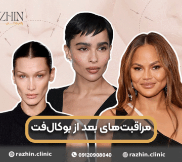 مراقبت های بعد از بوکال فت