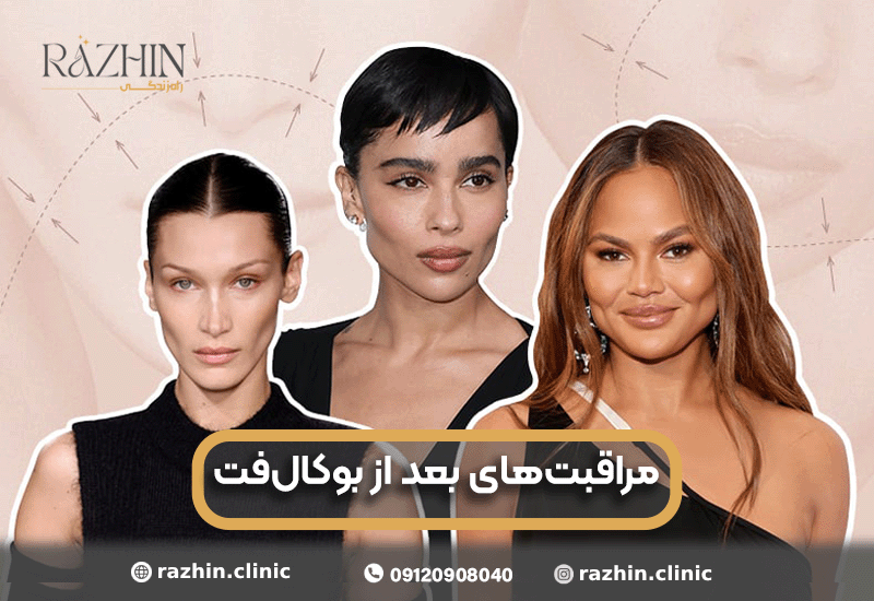 مراقبت های بعد از بوکال فت