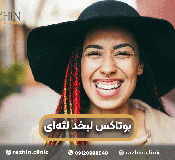 بوتاکس لبخد لثه ای