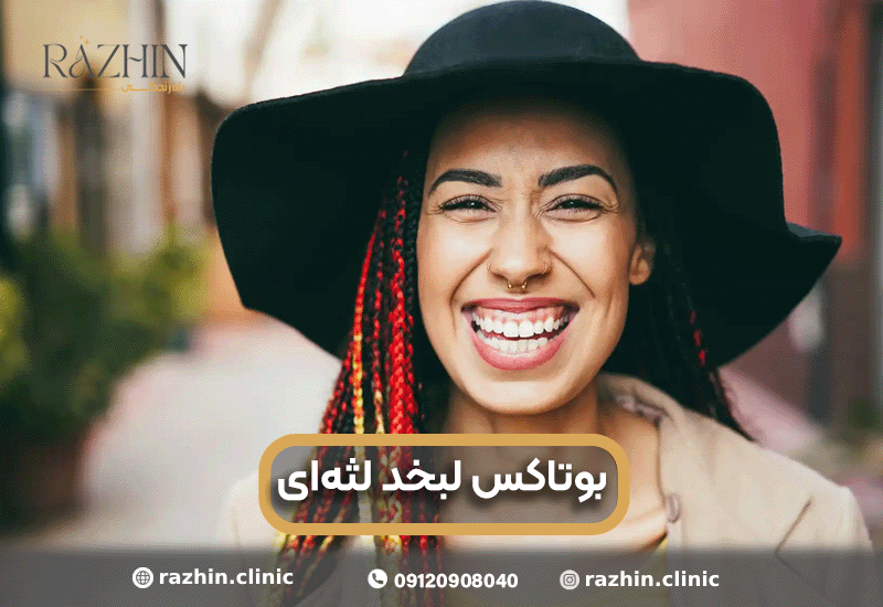 بوتاکس لبخد لثه ای