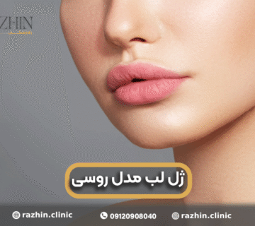 ژل لب مدل روسی