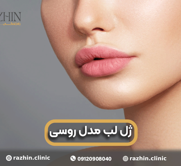 ژل لب مدل روسی