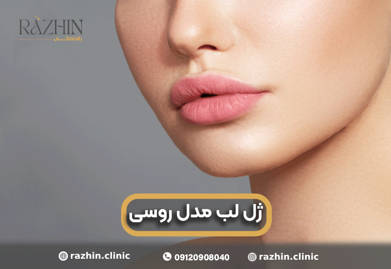 ژل لب مدل روسی