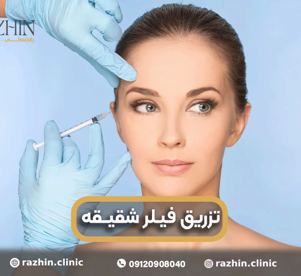 تزریق فیلر شقیقه در کلینیک راژین