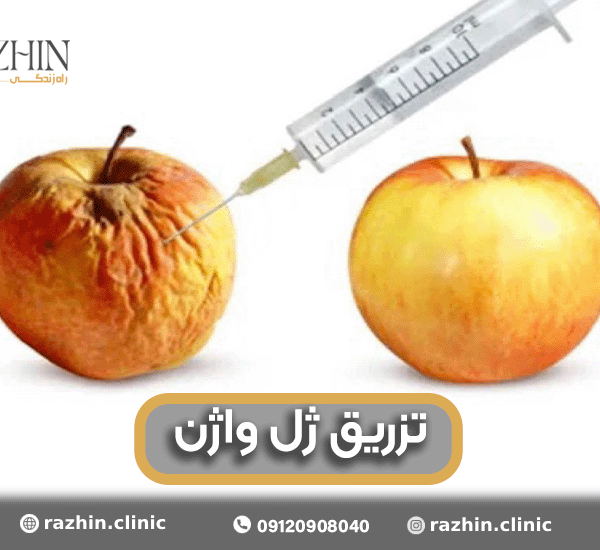 تزریق ژل واژن در کلینیک راژین