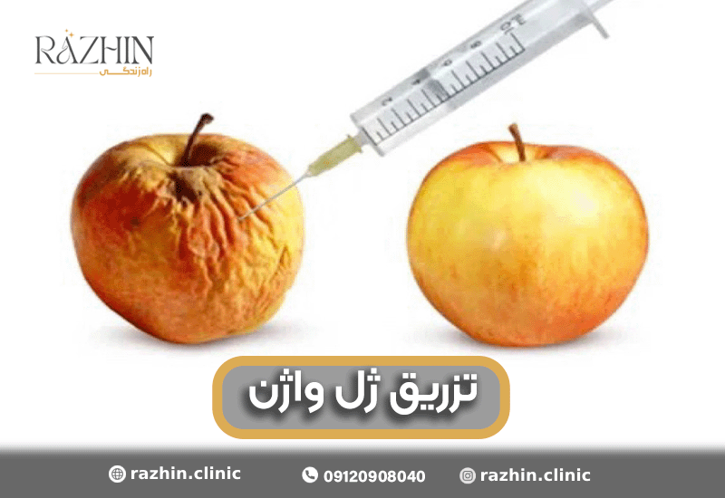 تزریق ژل واژن در کلینیک راژین