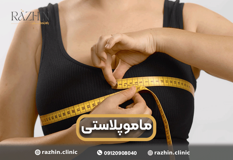 ماموپلاستی