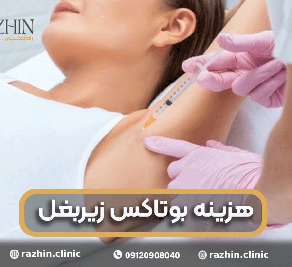 هزینه بوتاکس زیربغل 1404