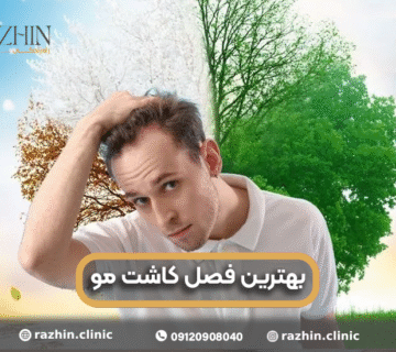 بهترین فصل کاشت مو