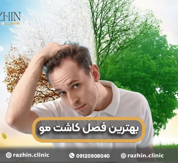 بهترین فصل کاشت مو