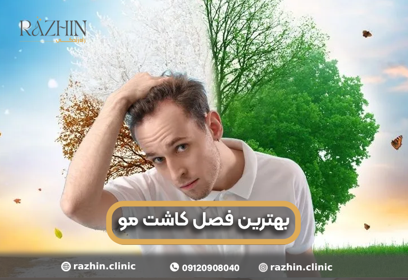 بهترین فصل کاشت مو
