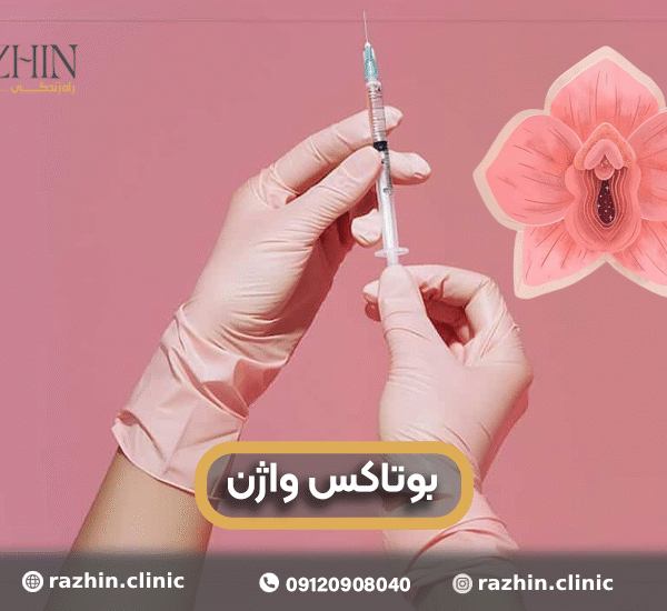 بوتاکس واژن