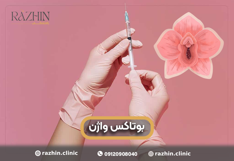 بوتاکس واژن