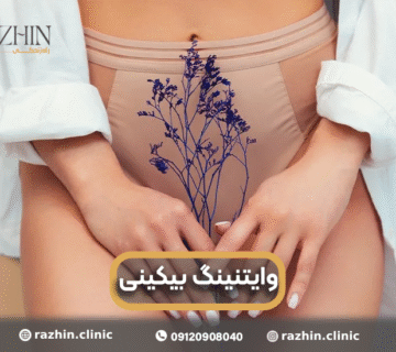 وایتنینگ بیکینی