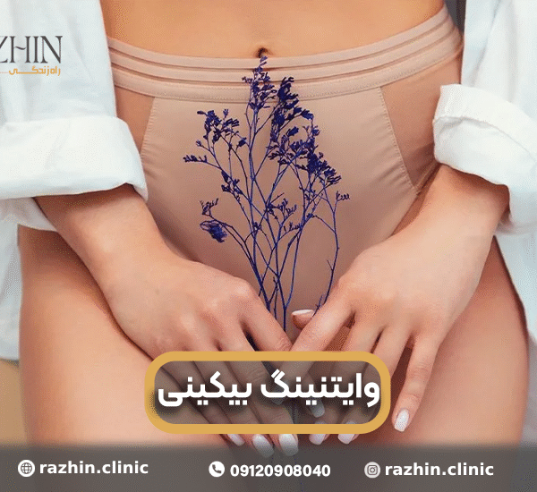 وایتنینگ بیکینی