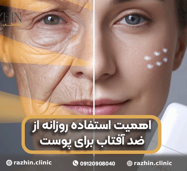 اهمیت استفاده روزانه از ضدآفتاب