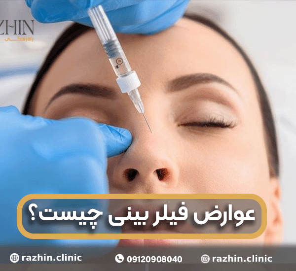 عوارض فیلر بینی چیست؟