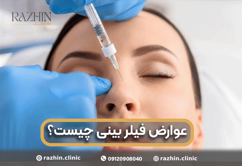عوارض فیلر بینی چیست؟