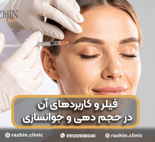 فیلر و کاربرد های آن