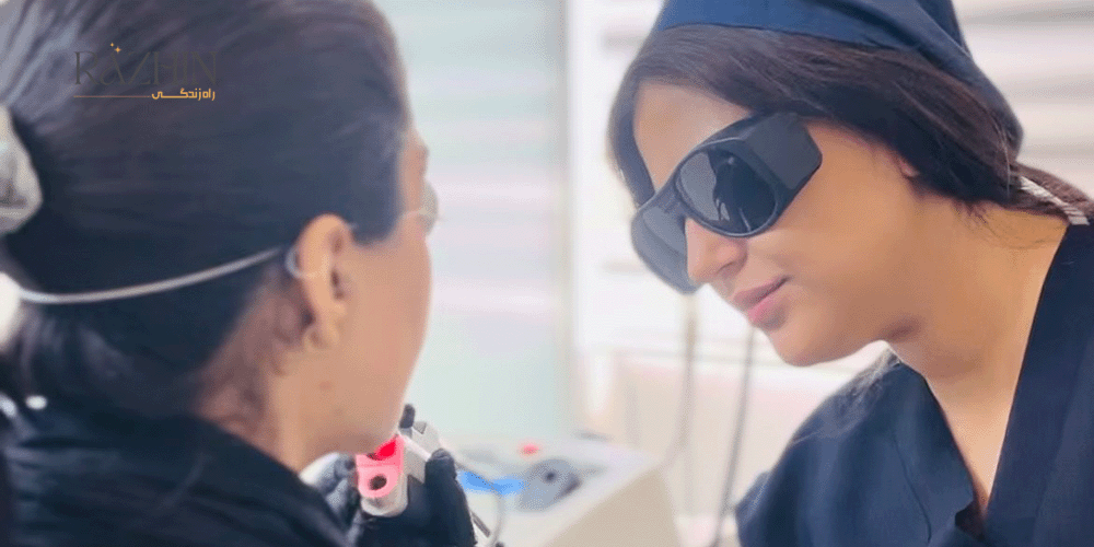 لیزر الیت پلاس