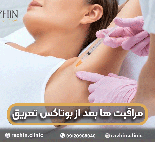 مراقبت ها بعد از بوتاکس تعریق
