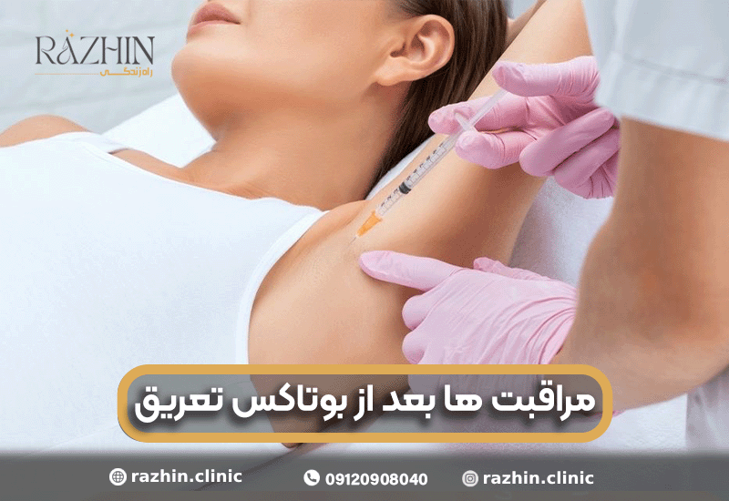 مراقبت ها بعد از بوتاکس تعریق