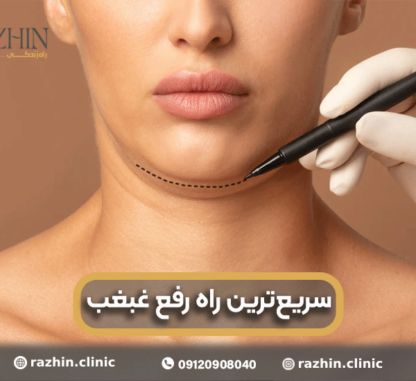 سریع ترین راه رفع غبغب