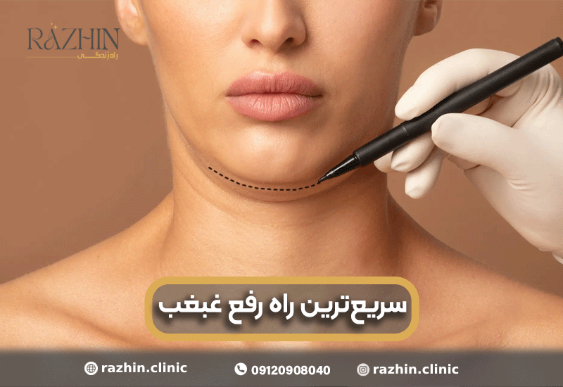 سریع ترین راه رفع غبغب