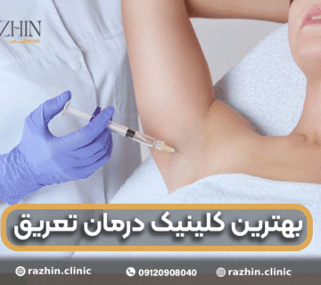 بهترین کلینیک درمان تعریق در تهران