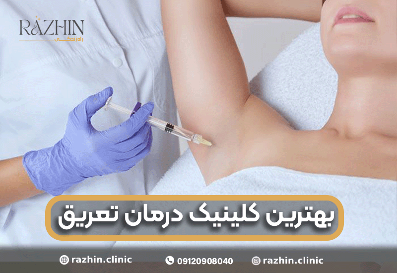 بهترین کلینیک درمان تعریق در تهران