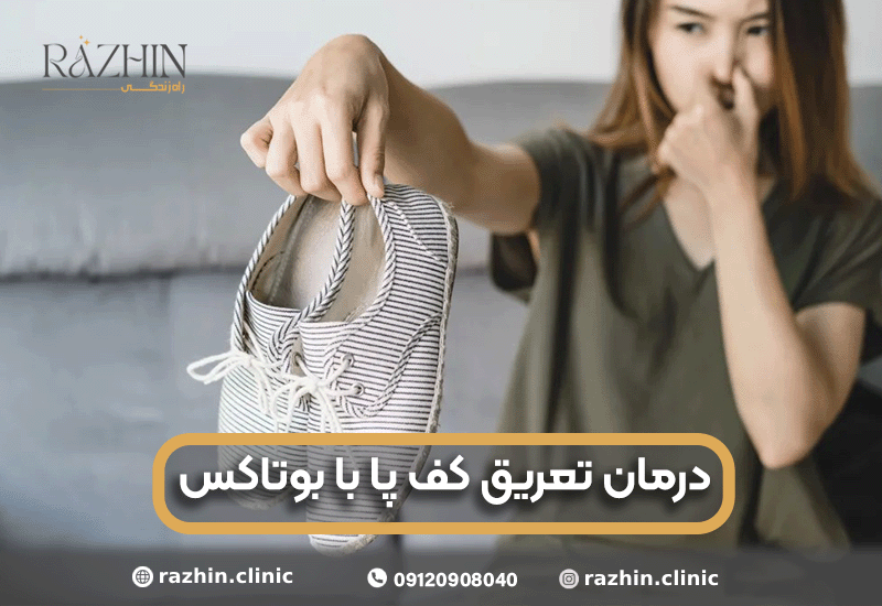 درمان تعریق کف پا با بوتاکس