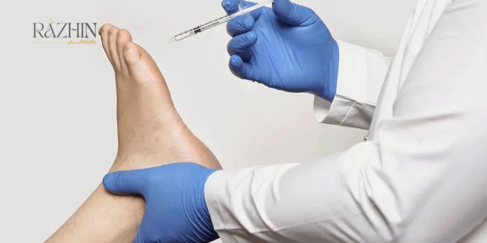 درمان تعریق کف پا