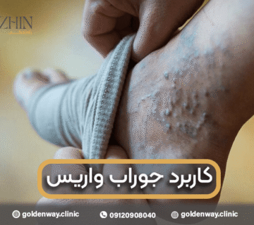 کاربرد جوراب واریس