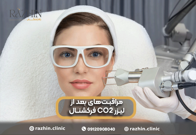 مراقبت های بعد از لیزر CO2 فرکشنال
