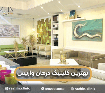 بهترین کلینیک درمان واریس