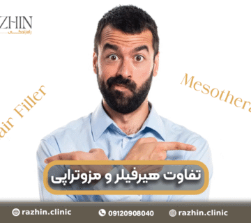 تفاوت هیر فیلر و مزوتراپی