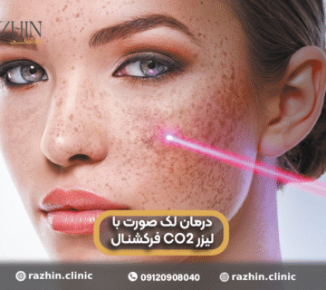 درمان لک صورت با لیزر CO2 فرکشنال