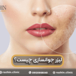 لیزر جوانسازی