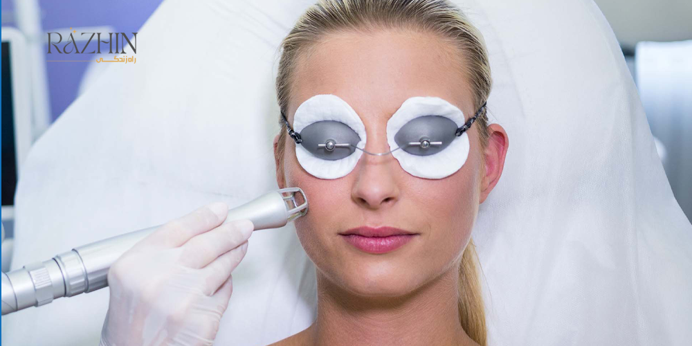 لیزر جوانسازی