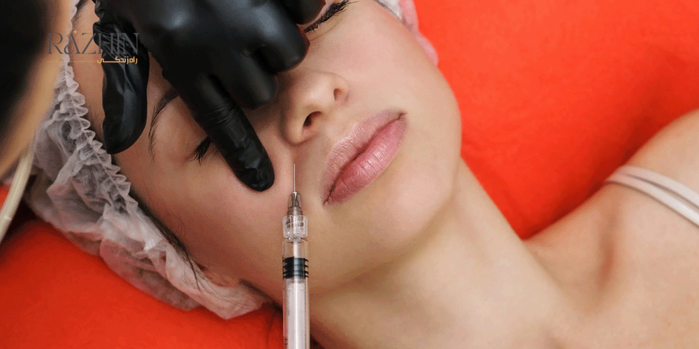 تزریق ژل خط خنده