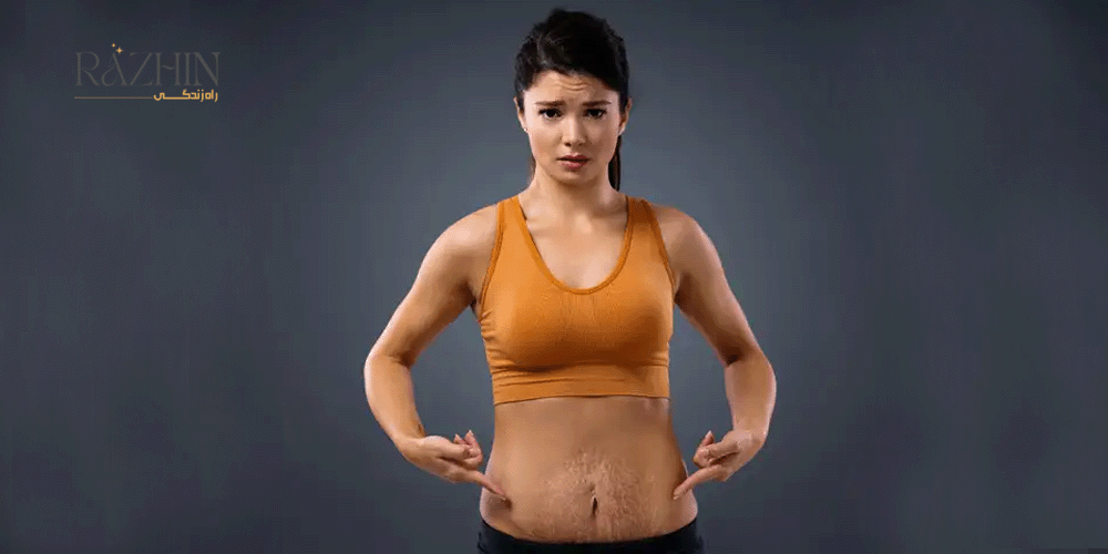 درمان ترک پوستی