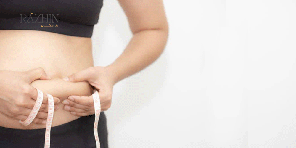 آر اف لاغری