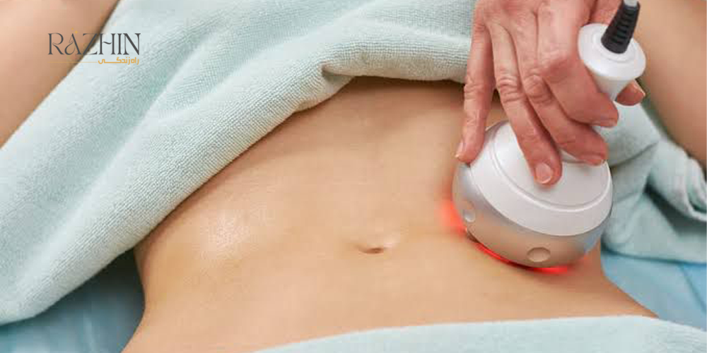 آر اف لاغری