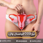 لیزر CO2 فرکشنال واژینال