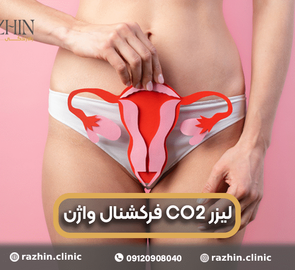 لیزر CO2 فرکشنال واژینال