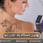 بهترین دستگاه پاک کردن تتو