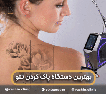 بهترین دستگاه پاک کردن تتو